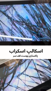 اسکالپ سر اندیشه
